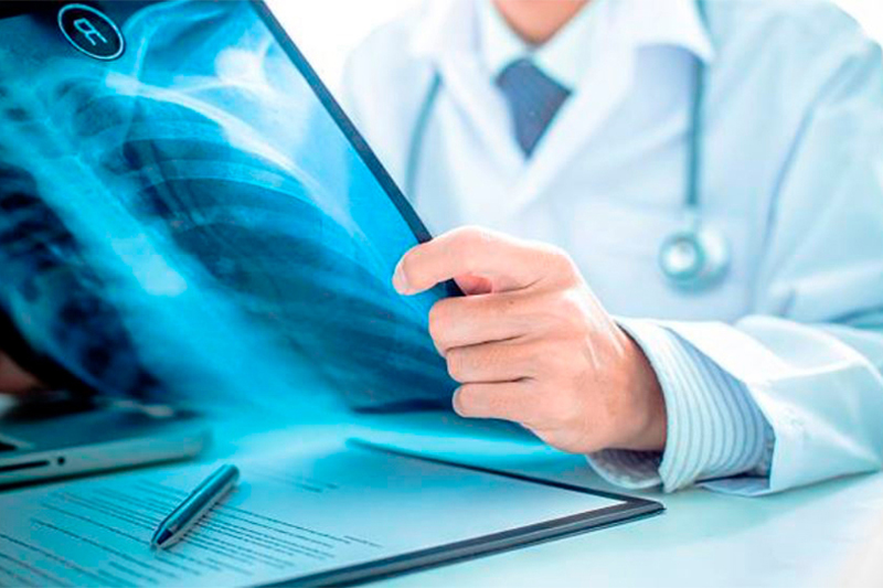 Schmuckbild: Röntgenbild einer Lunge in den Händen eines Arztes am Schreibtisch