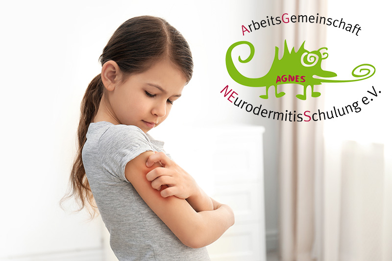 Schmuckbild: ein Mädchen, das sich eine gerötete Stelle am Oberarm kratzt; darauf das Logo und der Schriftzug der Arbeitsgemeinschaft Neurodermitis e.V.