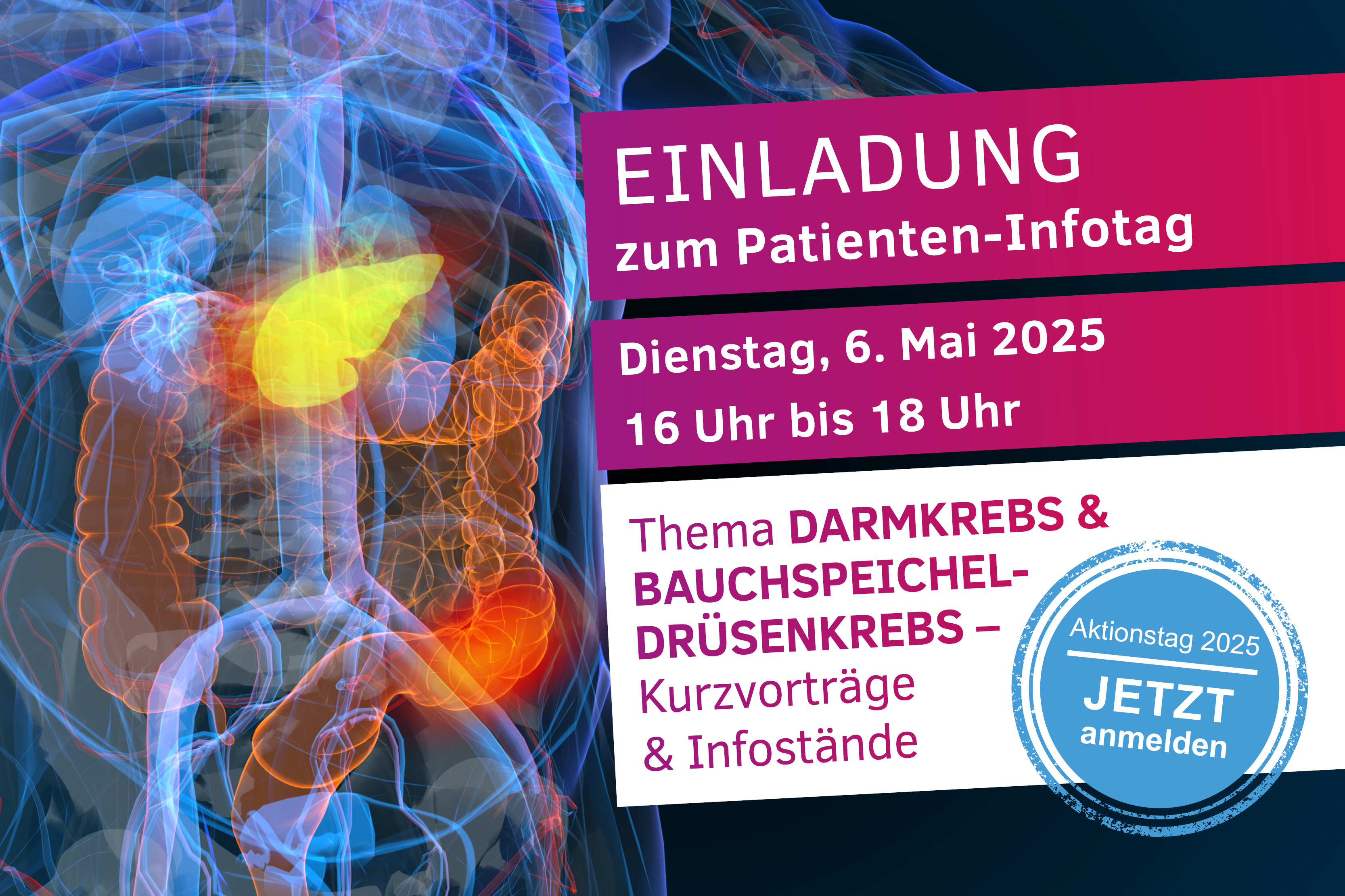 Illustration des Darms und Pankreas mit Text: Einladung zum Patienten-Infotag. Dienstag, 6. Mai 2025. 16 Uhr bis18 Uhr. Thema Darmkrebs & Bauchspeicheldrüsenkrebs. Kurzvorträge und Infostände. Aktionstag 2025 Jetzt anmelden.