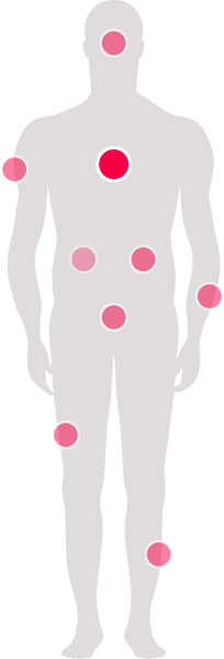Körper-Grafik mit verschiedenen markierten Bereichen